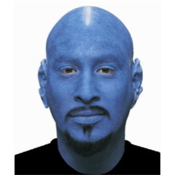 Picture of BALD CAP - BLUE